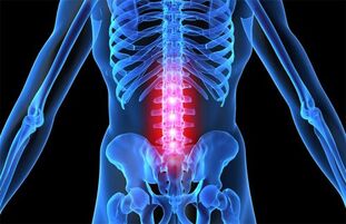 ublažava bolove u zglobovima kod osteohondroze