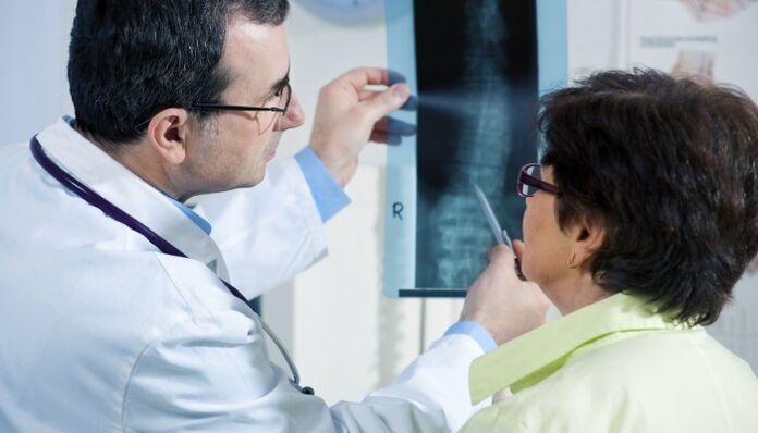 röntgen chrbtice s osteochondrózou