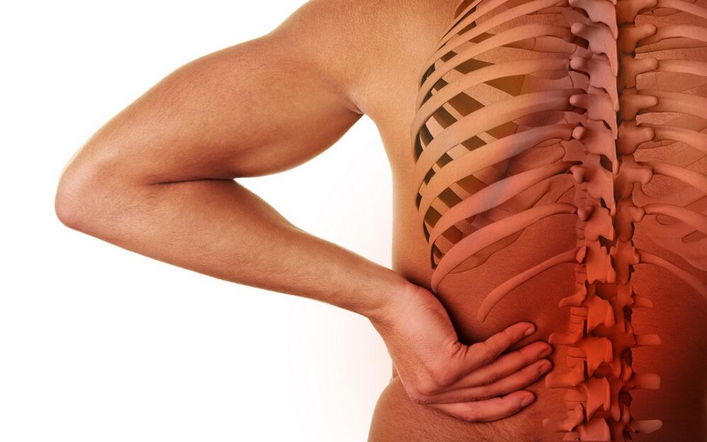 bolesť chrbta v dôsledku osteochondrózy