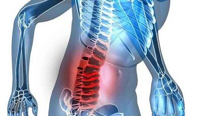 Príznaky a príznaky bedrovej osteochondrózy