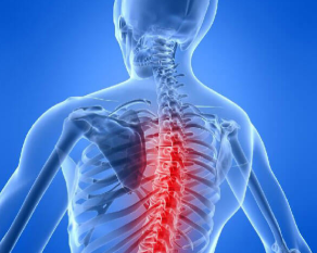 Osteochondrosis chrbtice